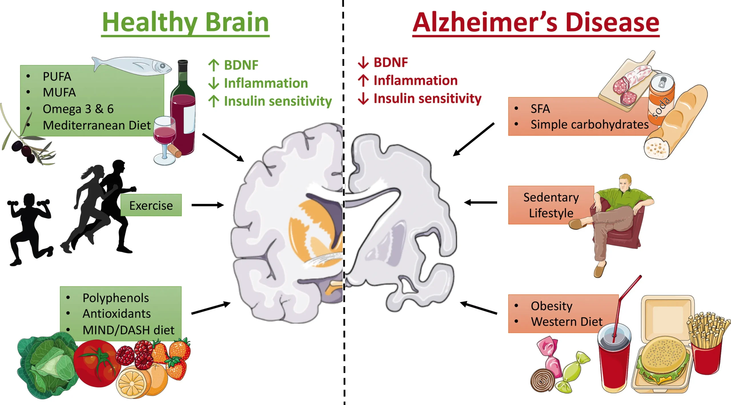 Alzheimer's prevention, cognitive decline, exercise benefits, brain health, mild cognitive impairment, dementia prevention, memory loss