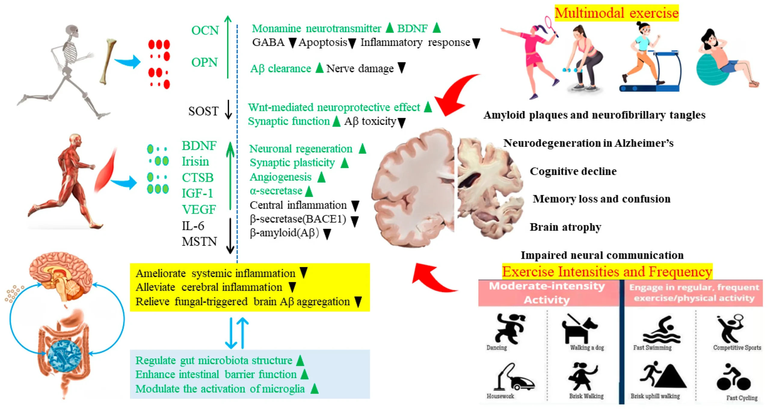 Alzheimer's prevention, cognitive decline, exercise benefits, brain health, mild cognitive impairment, dementia prevention, memory loss