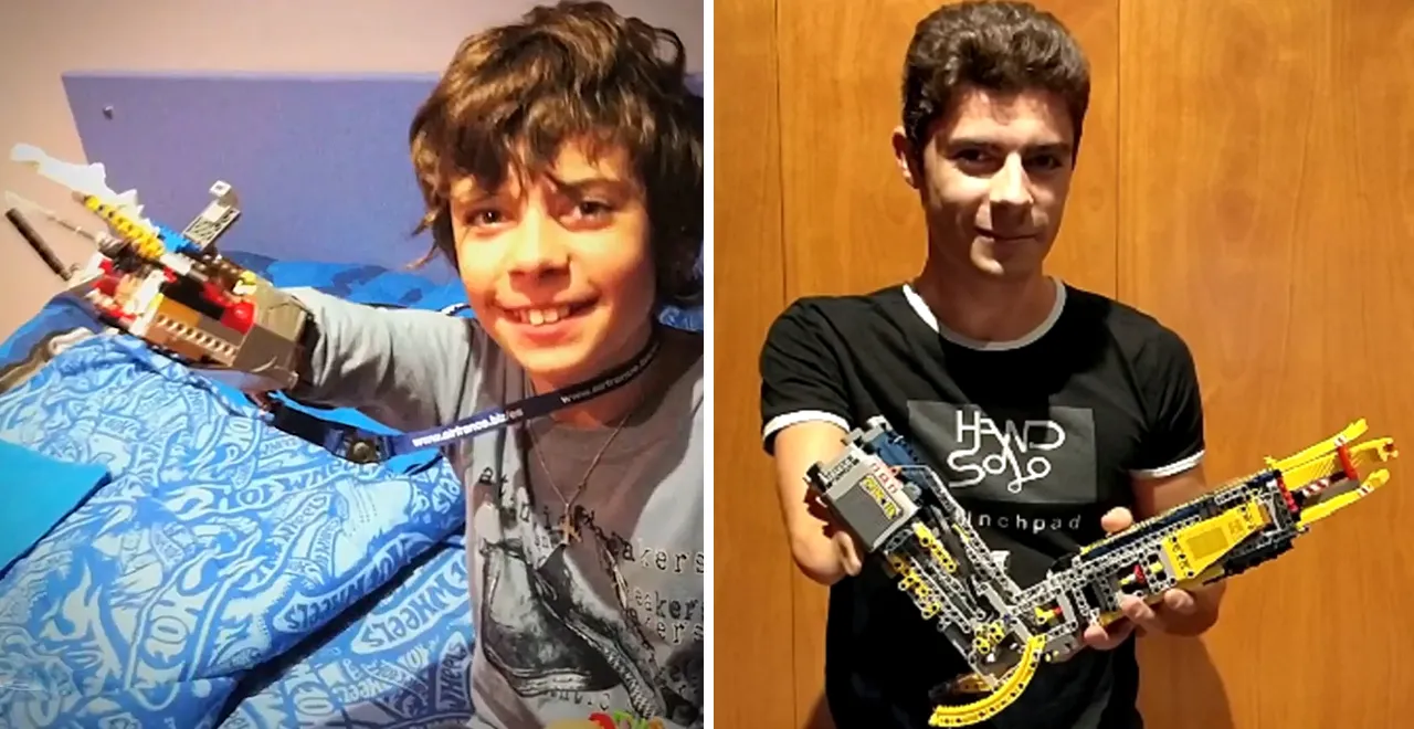 Teen New Bionic Hands Can Literally Go On Solo Missions