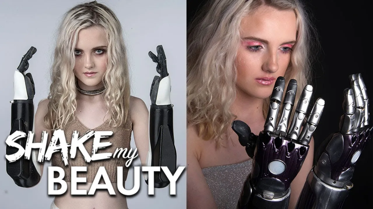 Teen's New Bionic Hands Can Literally Go On Solo Missions