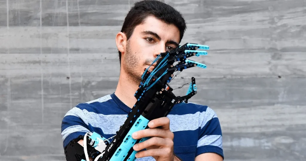 Teen's New Bionic Hands Can Literally Go On Solo Missions